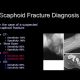 Scaphoid Fracture Diagnosis