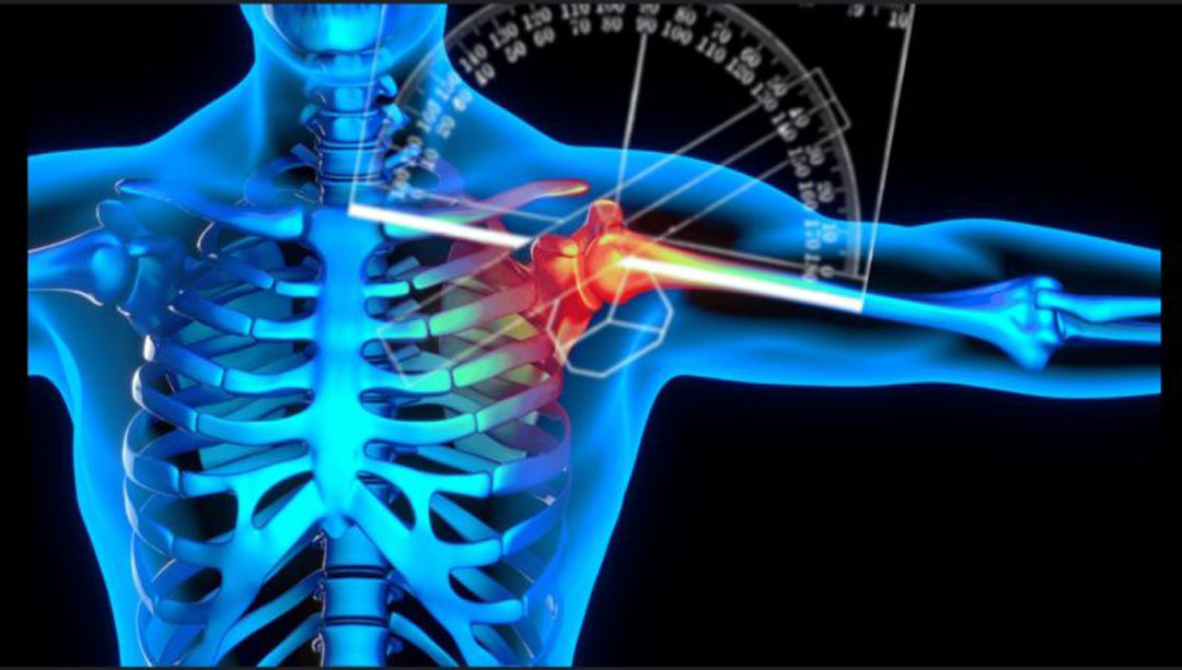 Shoulder ROM and Goniometers โ telepatron