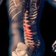 Chiropractic Adjustment vs Spinal Decompression