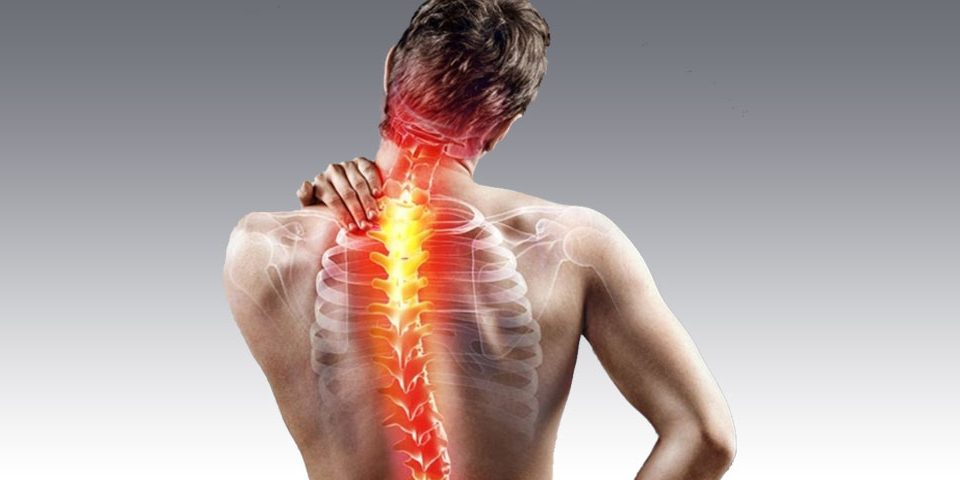 Scoliosis and Neurolog