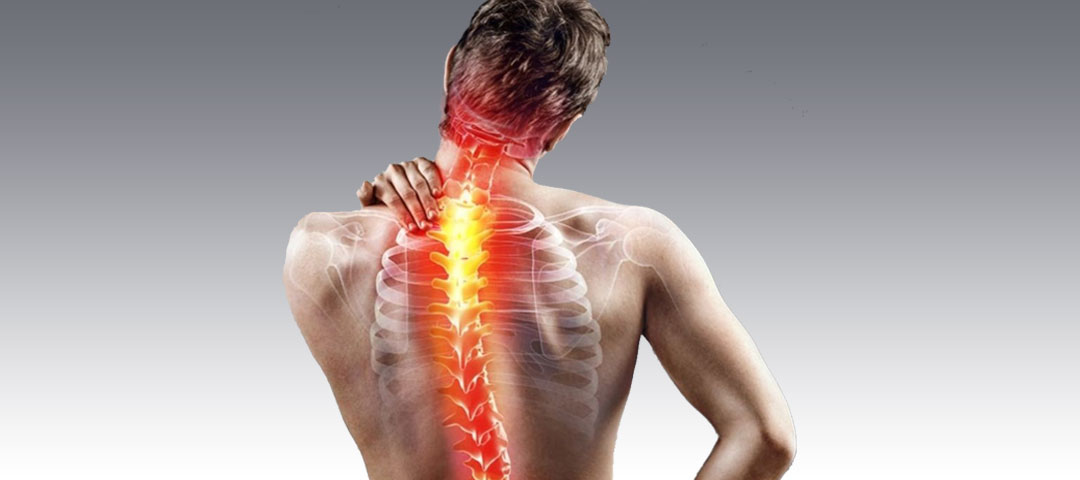 Scoliosis and Neurolog